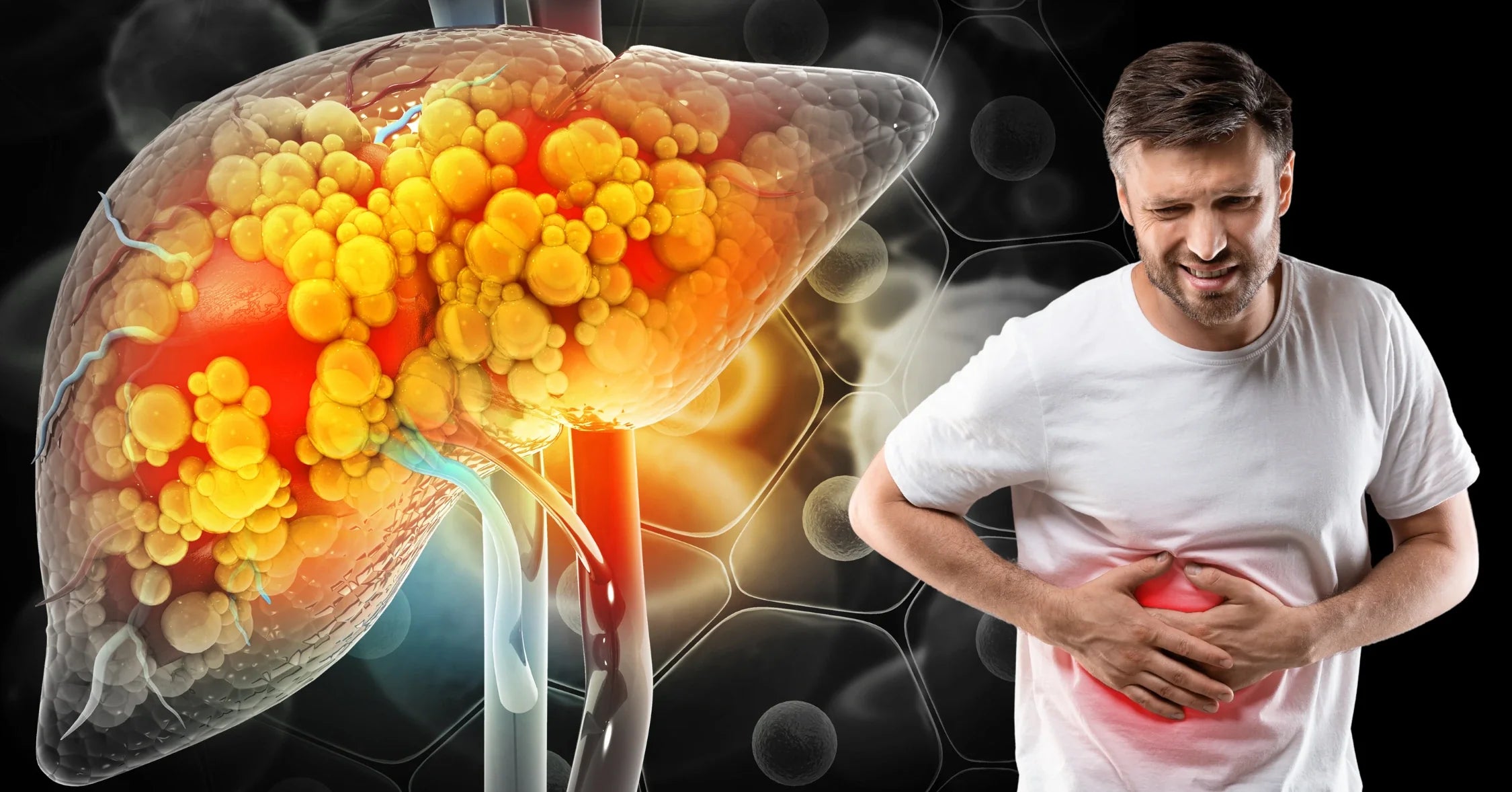 الكبد الدهني (Fatty Liver): مرض صامت يهدد صحتك.. متى يصبح خطيراً؟